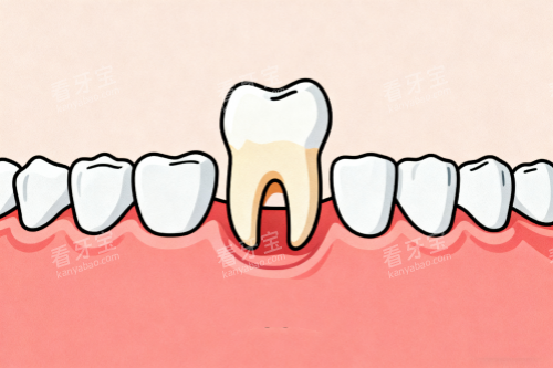 拔牙卡通图 拔牙卡通图