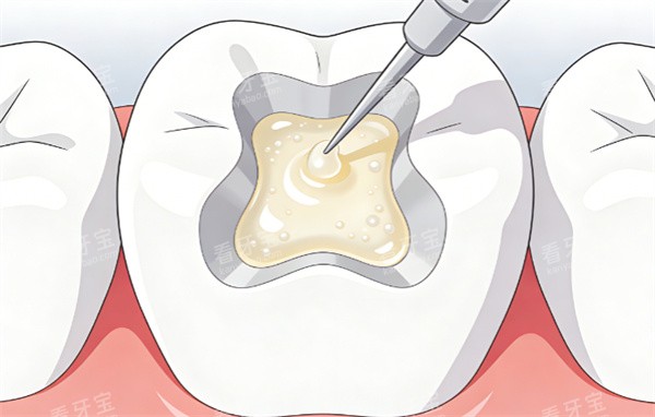 ������֬�������ʾ��ͼ