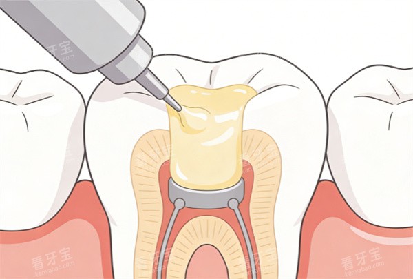 ������֬������俨ͨչʾͼ