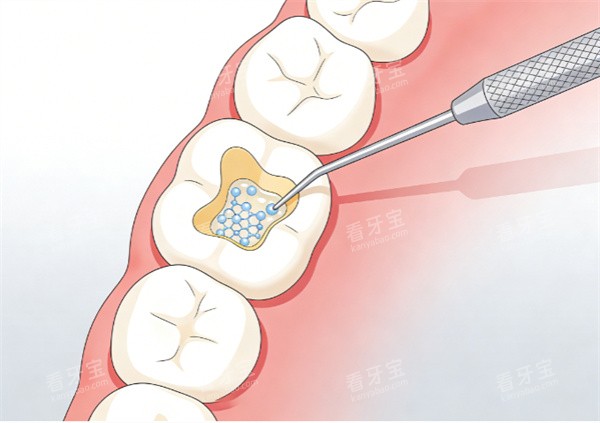 ������֬�������չʾͼ