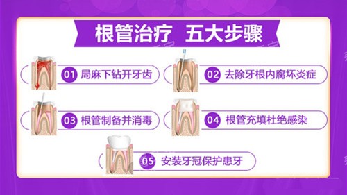 �������ƵĲ���