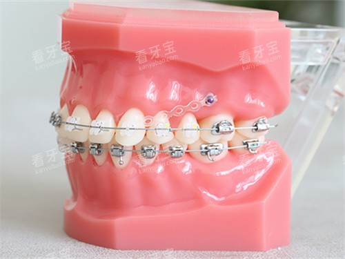 ���ݽ����������մ��в�����ģ��ͼ