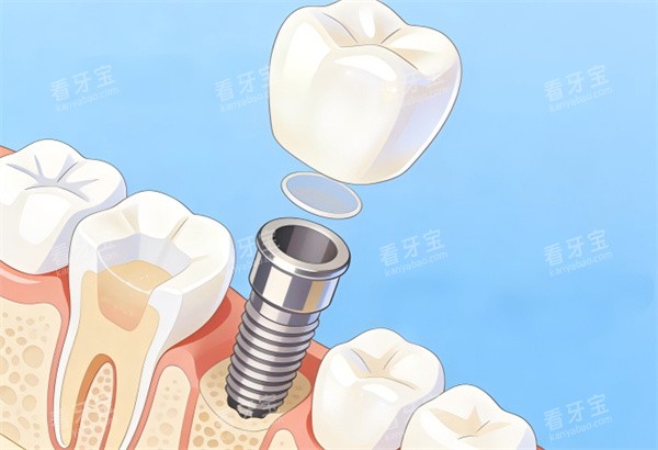 ������ֲ����ͨʾ��ͼ