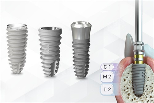 ����Ŧ������ֲ����ͬ�ͺ�