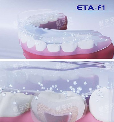 ETA���ݽ�����