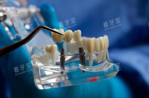 �۶���ֲ���ļҺã����ǰʮ���񵥸����㣡����ڱ�������10�����ƣ�������ѡ��Щ��