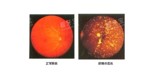 ��������Ǻ������۵׵ĶԱ�