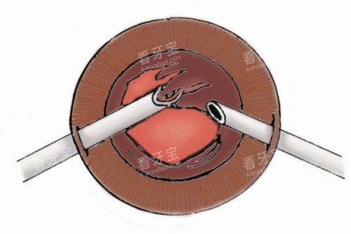 �������иͨͼ