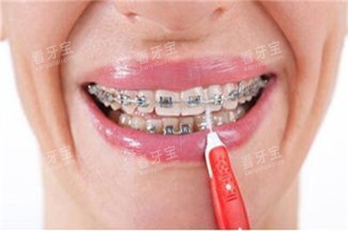 ��������������������ͼ