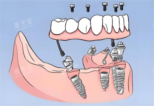 ȫ����ֲ����ͨͼƬ