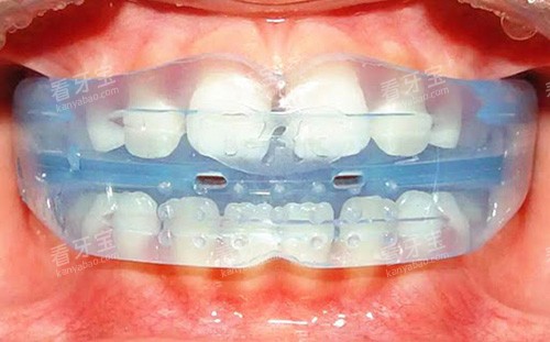 ���ݽ���MRC���ڼ����ܽ���