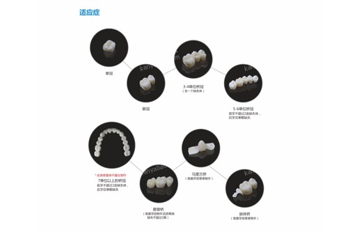 �������Ӱ������Ӧ֢ͼ