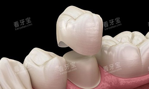 ���ڰ�װʾ��ͼ