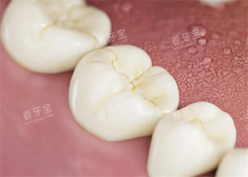 û����ȷˢ��������