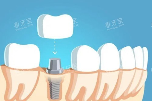 ��ֲ�������ڿ�ͨͼ