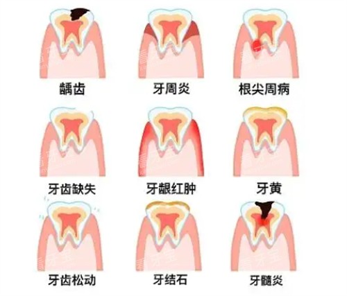 ��ͬ��������