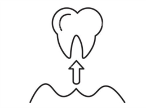 把牙齿拔出来 把牙齿拔出来