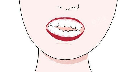 ��ǻ�������ʾ��ͼ