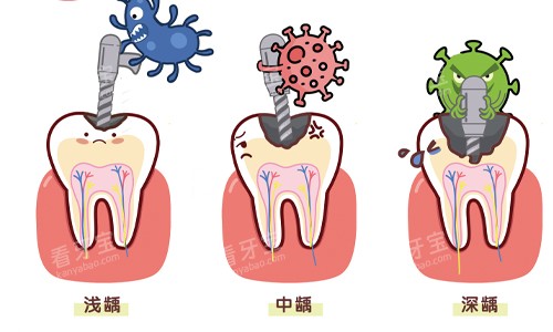 ���ݲ�ͬ�̶�ȣ��չʾ