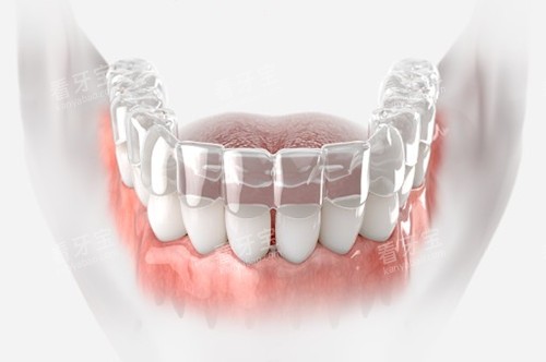 ������������ģ��ʾ��ͼ