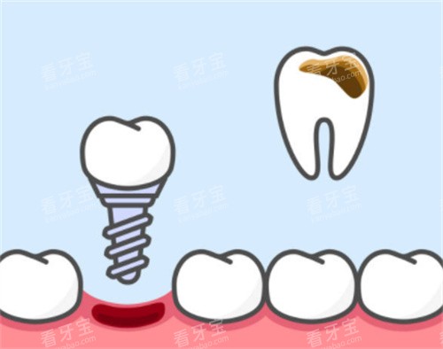 ���ݻ��˻���ֲ��