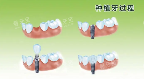 ��ֲ������ͼƬ