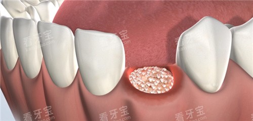 ֲ����������ͼƬ