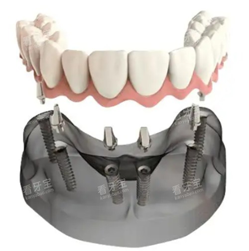 �����ֲ��