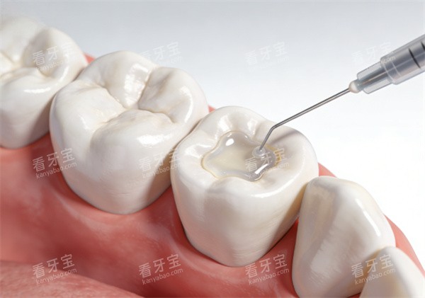 ��֬��������ͼƬʾ��ͼ