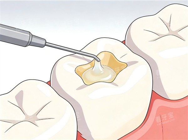 ������֬�������̶���ͼƬ