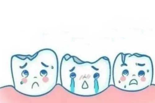 ����ȱ��ͨչʾͼ
