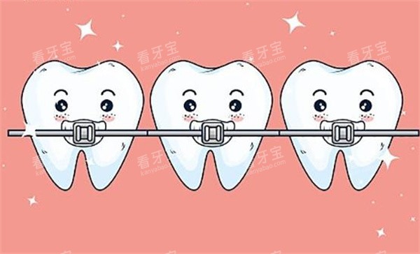 牙齿矫正卡通示意图 牙齿矫正卡通示意图