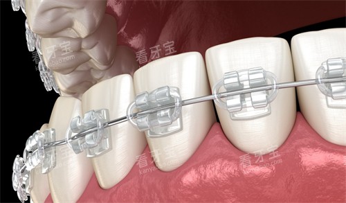 �в۽���չʾͼ