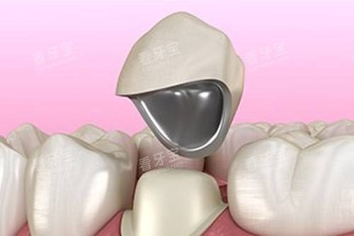 �����޸�ʾ��ͼ