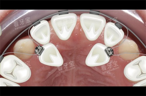 ��������ǣ��