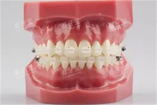 �����ν�������ģ��ͼ