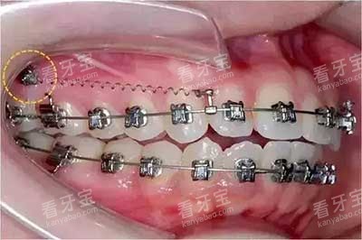 ���ݽ����Ƕ���ֲ��2