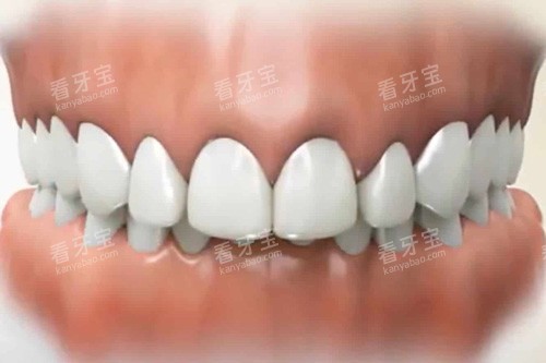 �������ʾ��ͼ