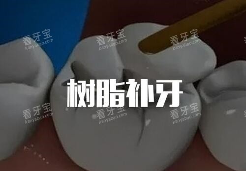 树脂补牙卡通 树脂补牙卡通