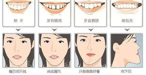 牙齿矫正脸型变化适应症 牙齿矫正脸型变化适应症