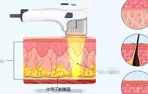 �������������ڽ�Ĥ�㶯��չʾ