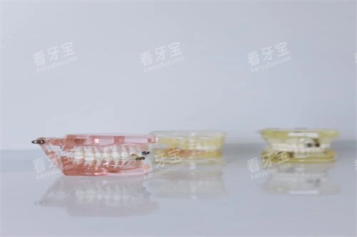 牙齿模型示意展示 牙齿模型示意展示