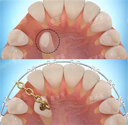 ��������ǣ��