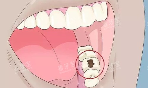 ���ݻ�����ô��