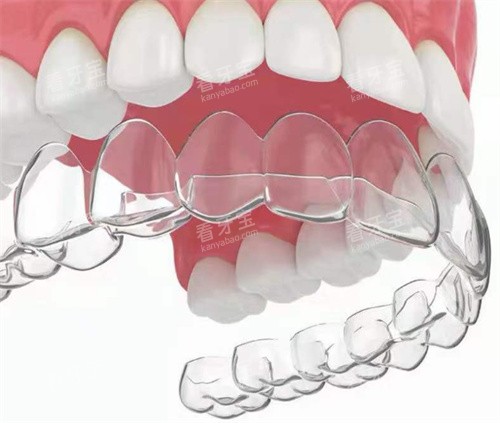 ���ν�������ʾ��ͼ