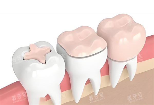 ����Ƕ���޸�