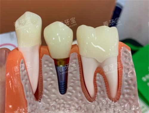 ��ֲ��ģ��չʾͼƬչʾ