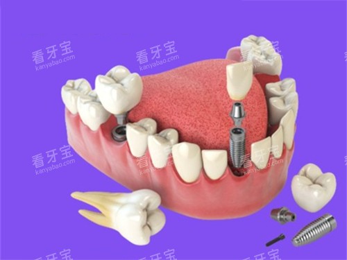 �����ֲ������ͼ