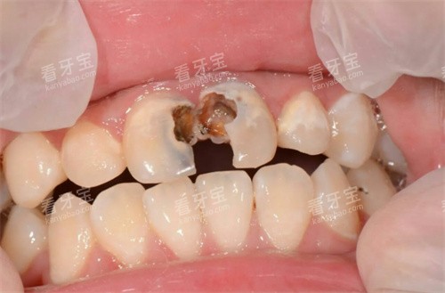 ����ȣ��