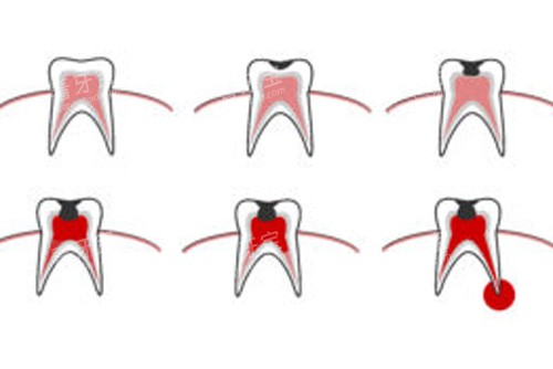 ������ʹ�ڲ�ʾ��ͼ